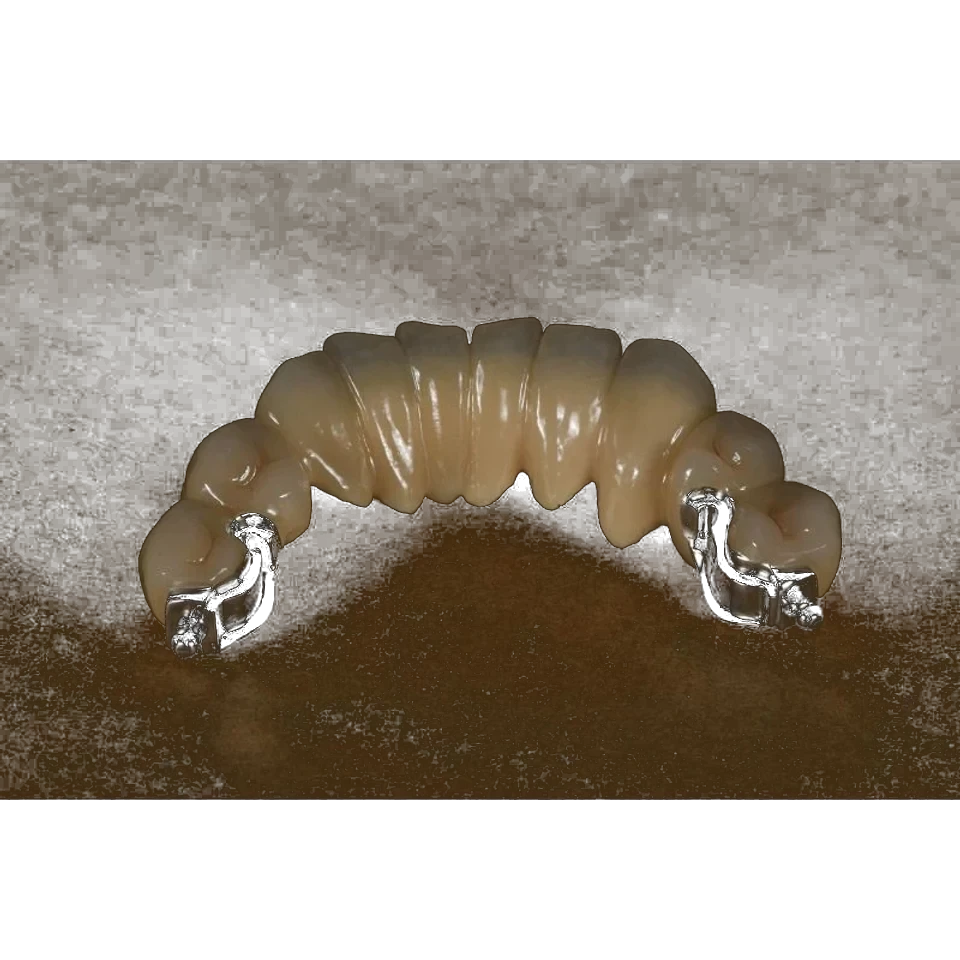 Partial denture framework prepared for precision attachments