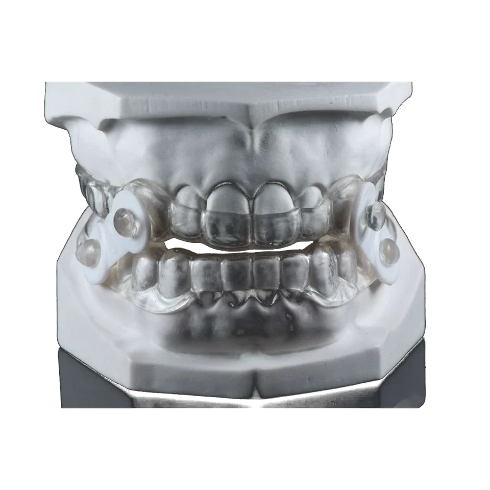 Removable oral appliance shown on a working model