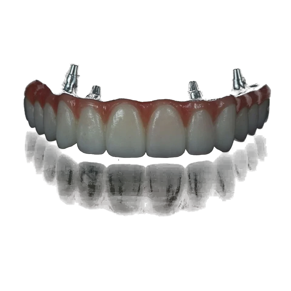 Milled temporary crown and bridge units on a working model