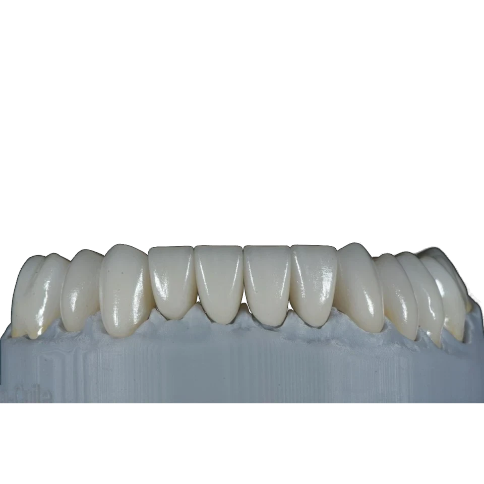 Multi-unit zirconia bridge on a working model